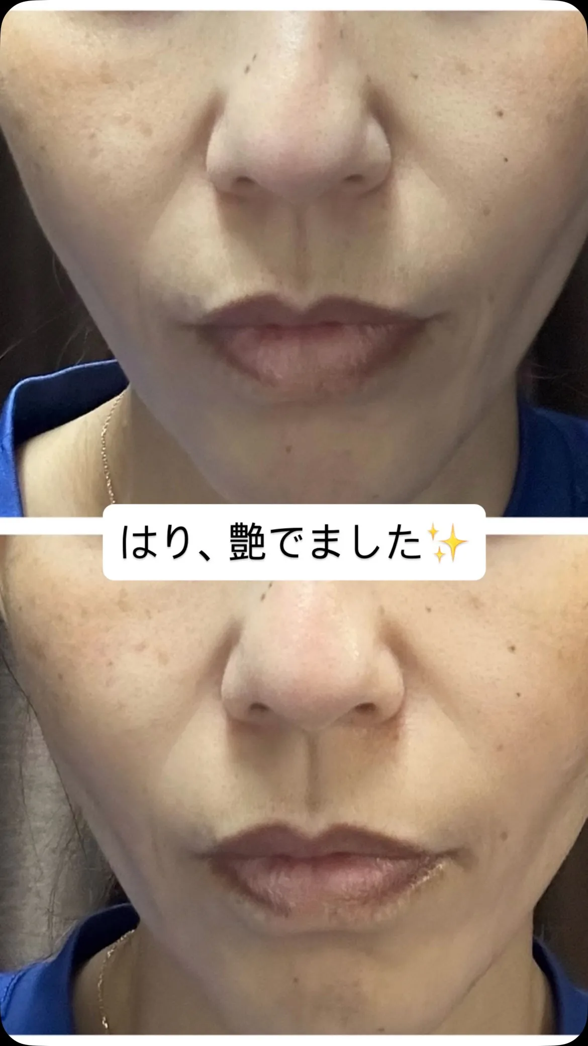 初のセラピール✨✨